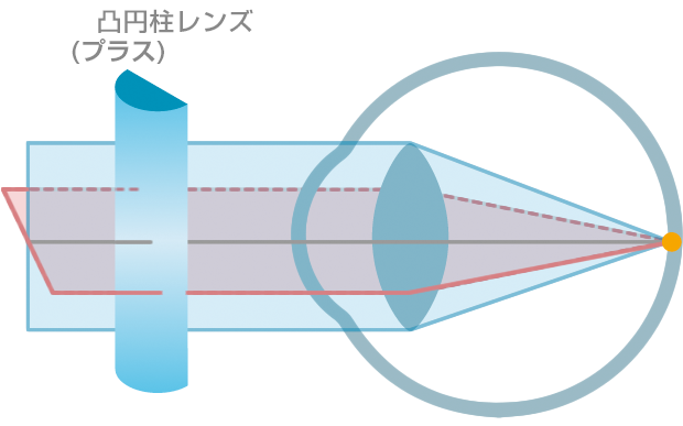 astigmatism_2.png astigmatism_2.png