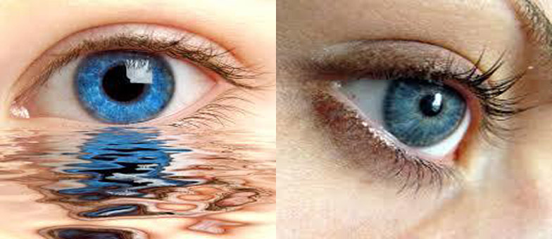 dryeye:784*340