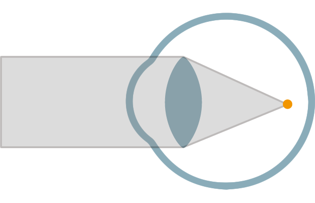 myopia_1.png myopia_1.png